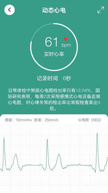 ECG°ͼ